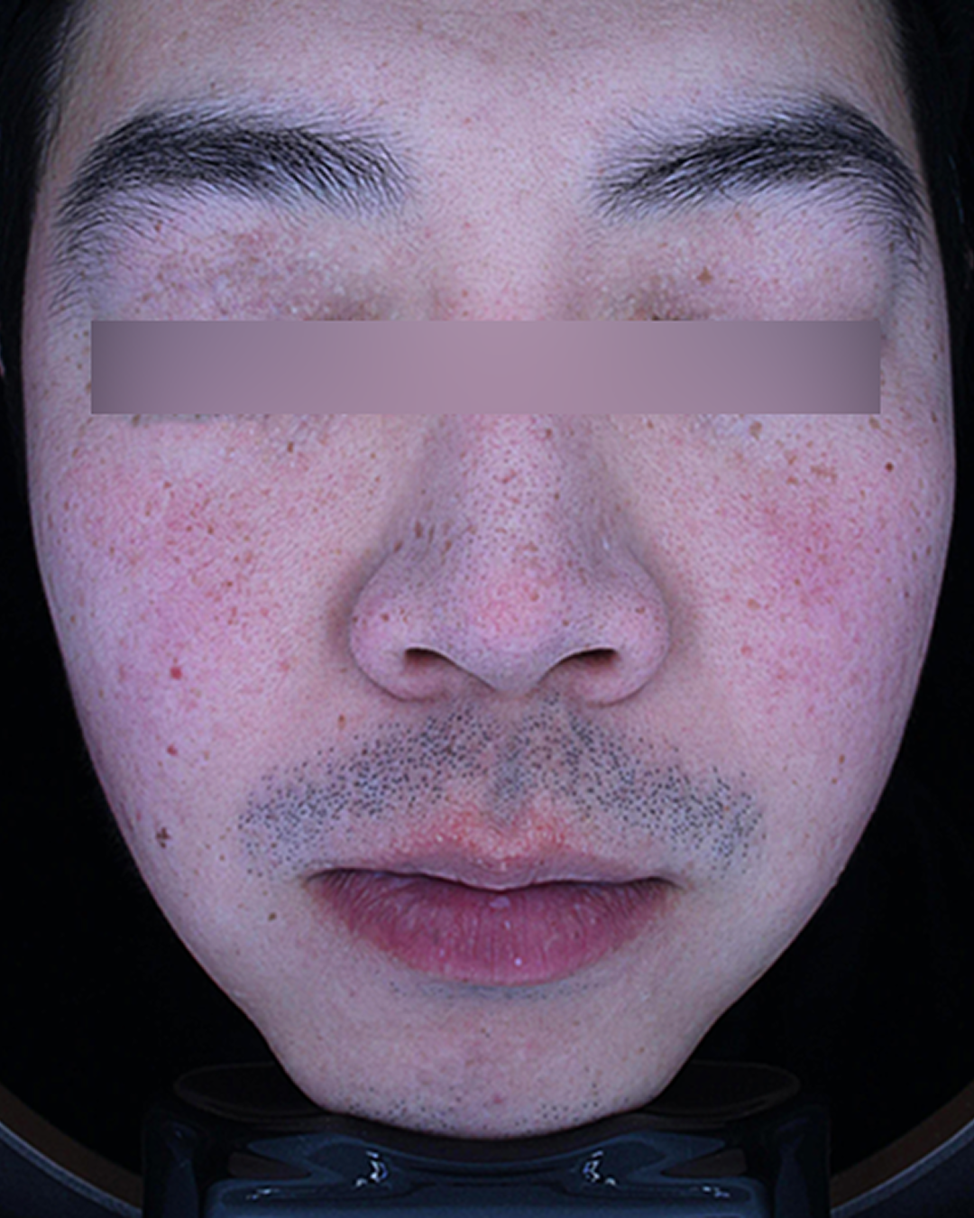 홍당무 5주 패키지