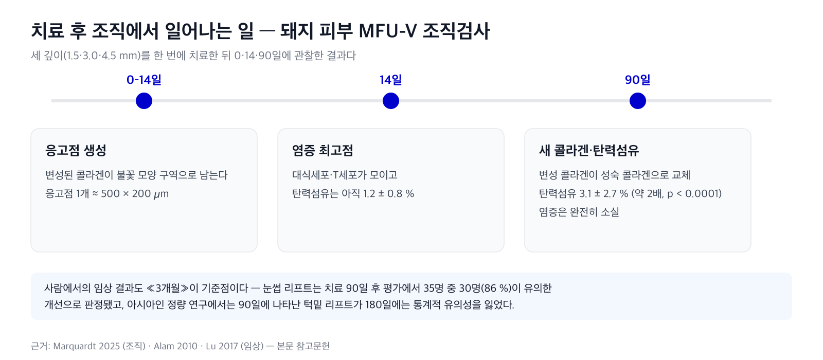 치료 후 조직 변화 타임라인 — 0일·14일·90일